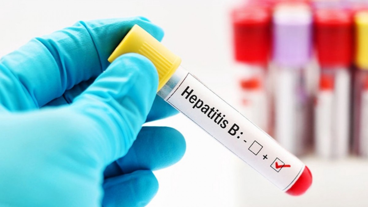 Türkiye'de gizemli hepatit vakası var mı?